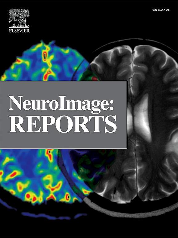 Go to journal home page - Neuroimage: Reports